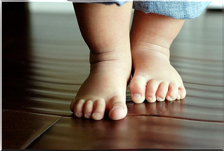 Bow legs in children are noticeable when toddlers spread their knees and project them outward.
